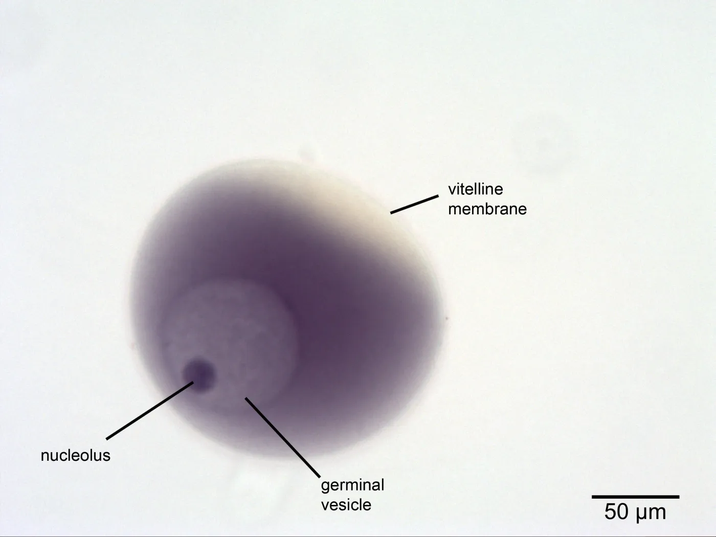 <p>unfertilized egg</p>