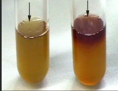<p>Which result is positive and which one is a negative voges-proskauer test?</p>