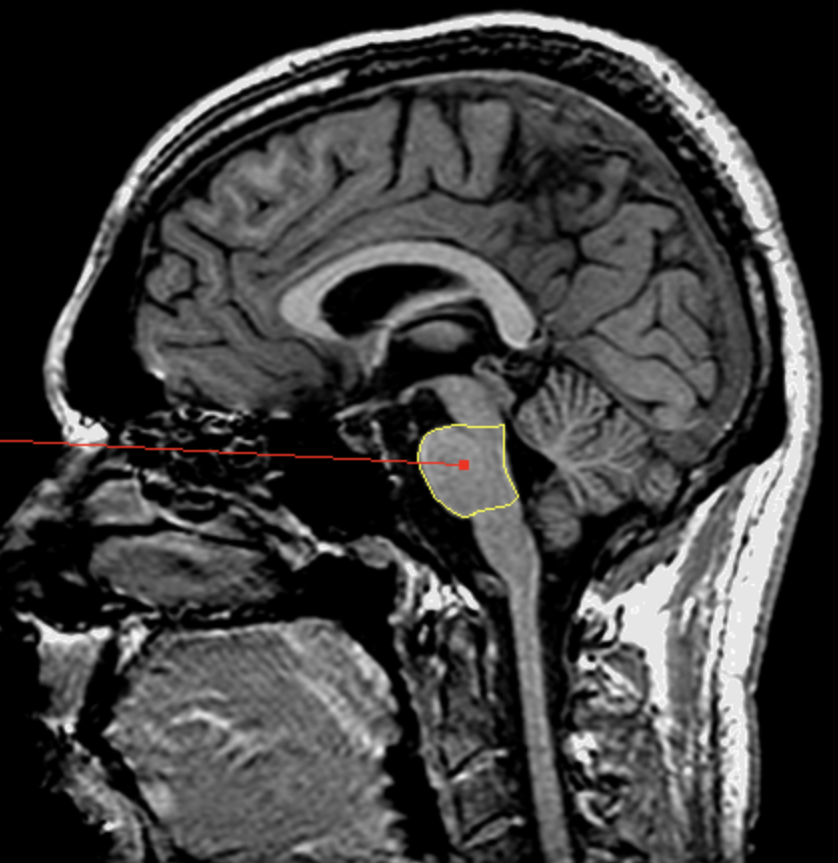 <p>What is the area highlighted called?</p>