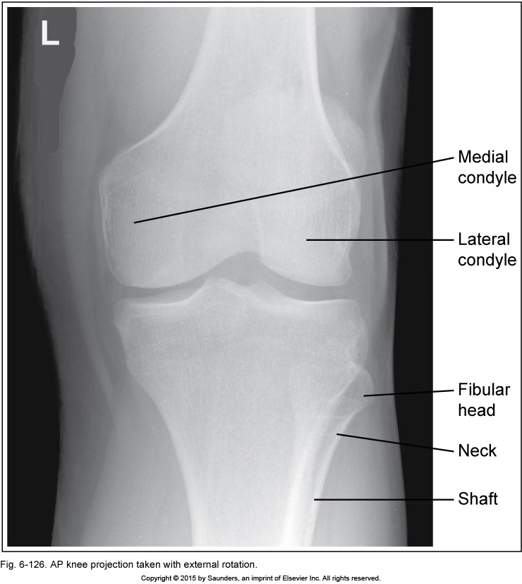 <p>AP knee</p>