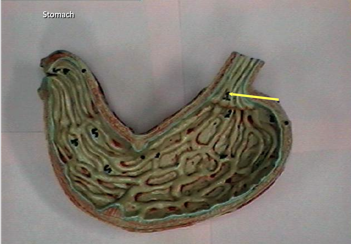 <p>Identify the organs of the digestive tract.</p>