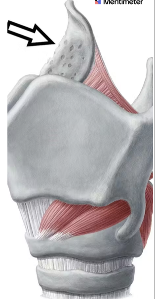 <p>the arrow points at what?</p>