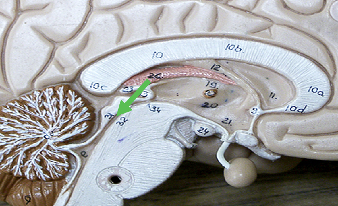 <p>Identify the <strong>space</strong> in the brain indicated by the pointer.</p>