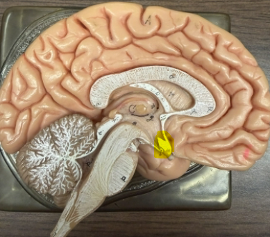 <p>what is the highlighted part</p>