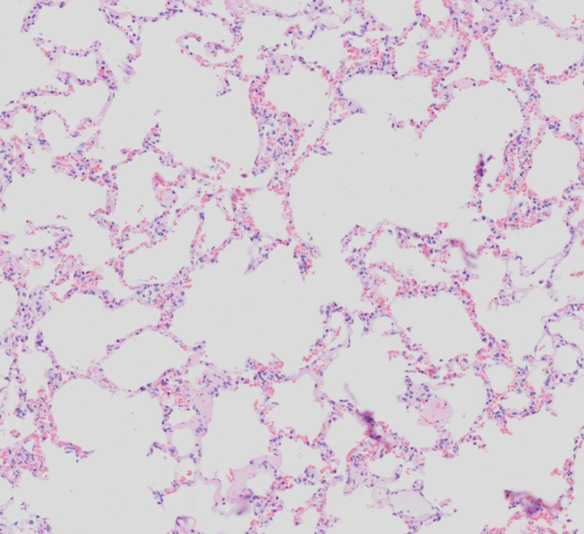 <p>Very thin walls lined mainly by simple squamous type I pneumocytes.</p>