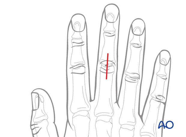 <p>What is this joint? </p>
