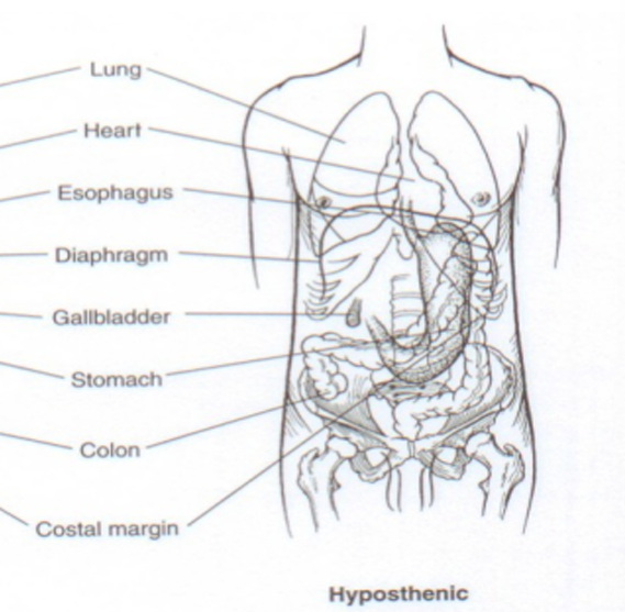 <p>Hyposthenic </p>