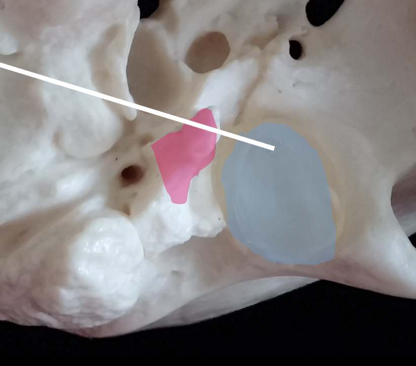 <p>From the inferior view, what is the pink region highlighted on the temporal bone?</p>