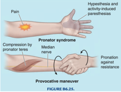 <p>Resisted pronation during elbow extension from 90° flexion; identifies median nerve entrapment.</p>