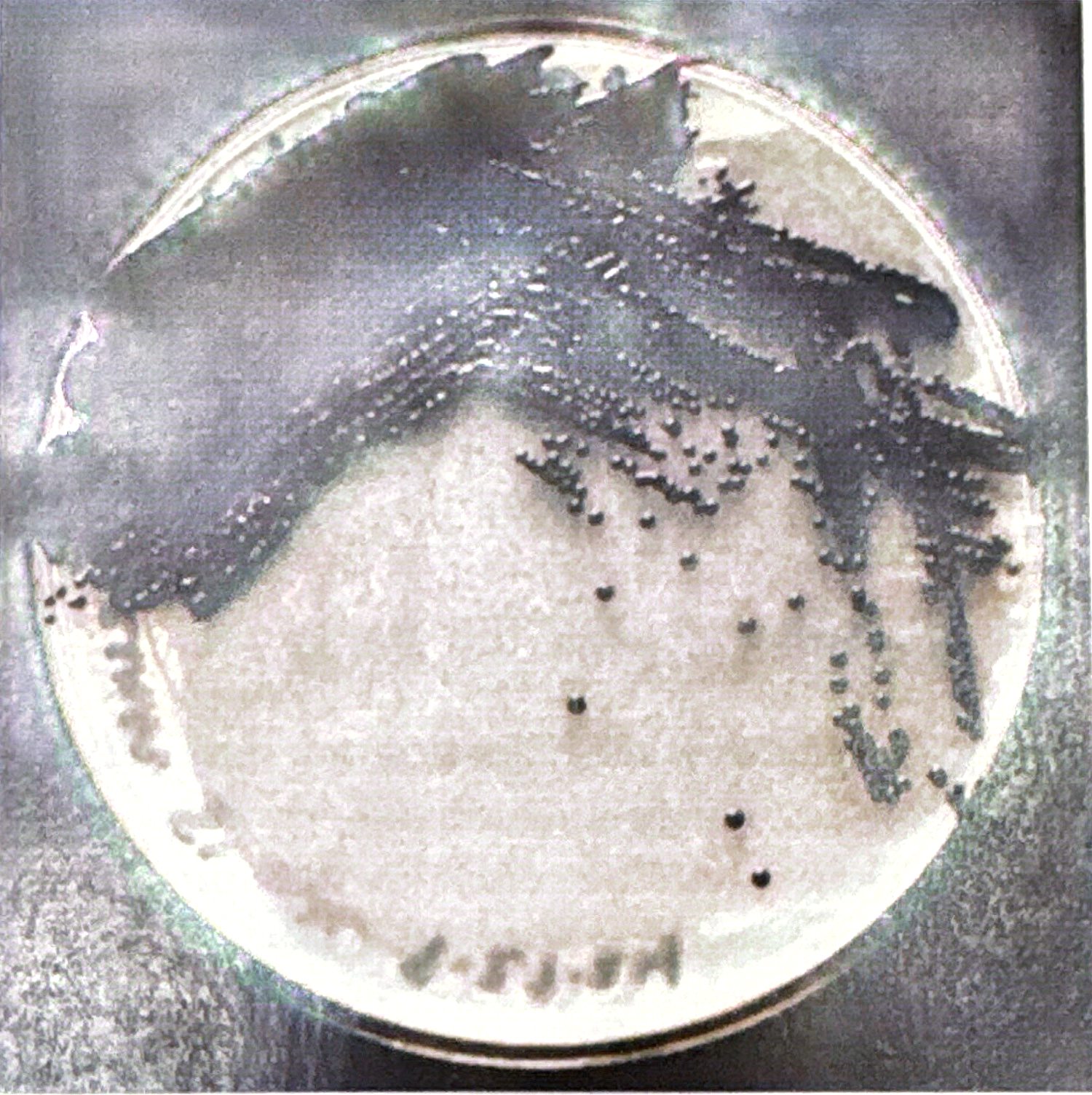 <p>Purple pigment</p>