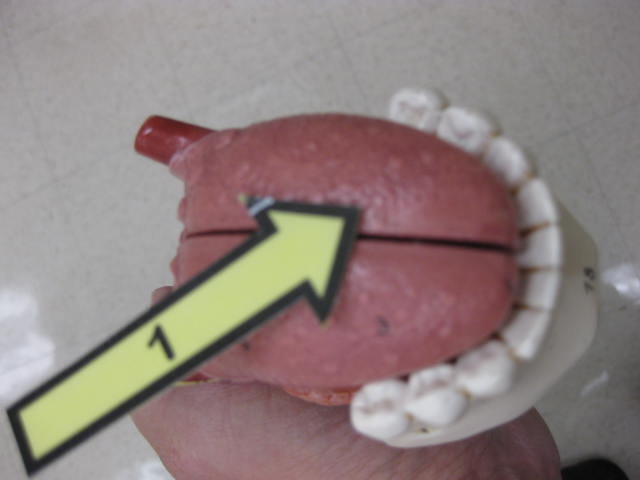 <p>Identify 1?</p><p>Lab Image 7-6</p>