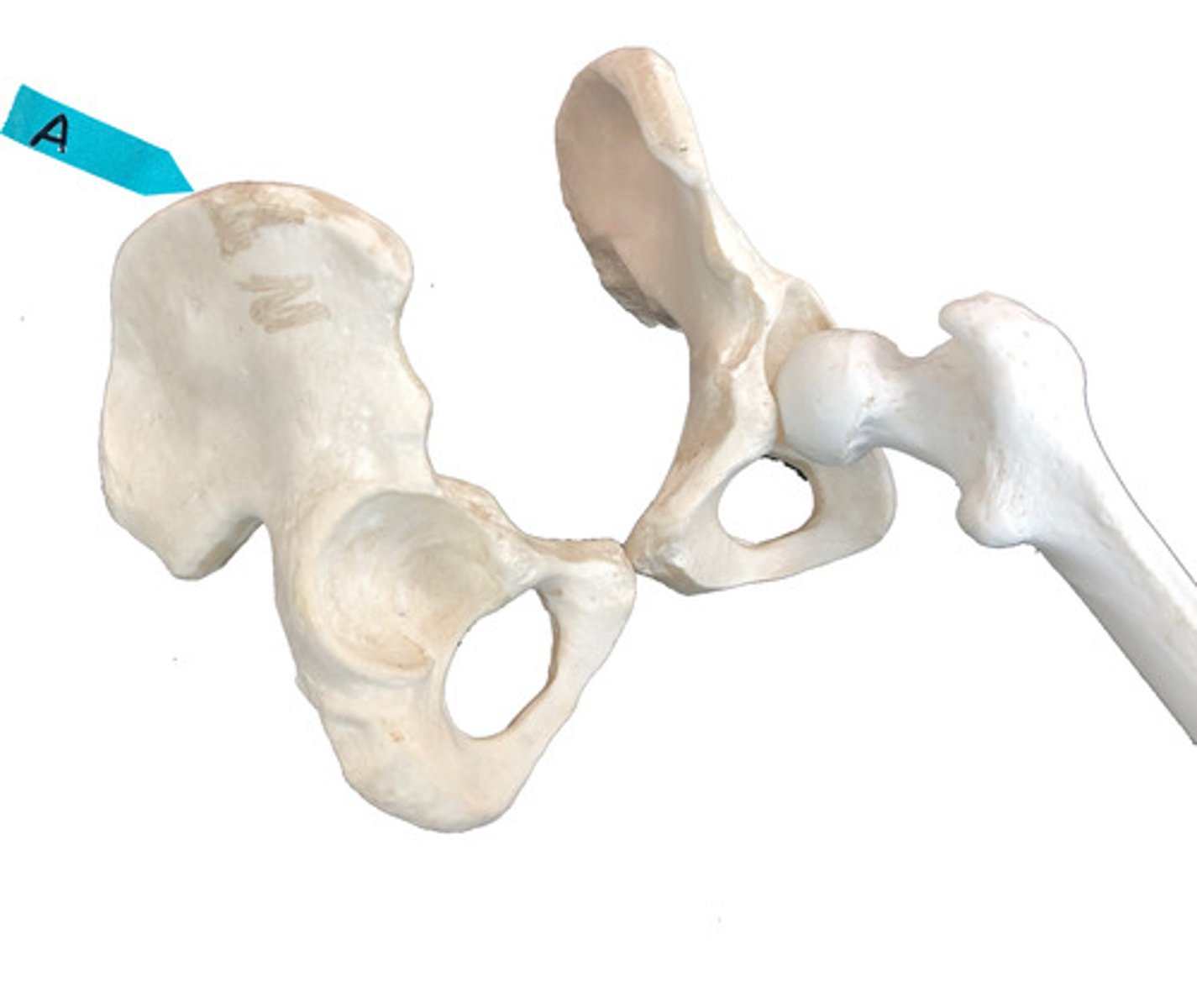 <p>mép trên</p>