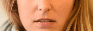 <p>Upper Lip Raiser</p>