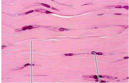 <p>what tissue is this</p>