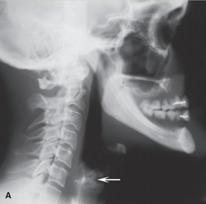 <p>what is the white arrow pointing to?</p>