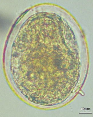 <p>Schistosoma species with small knob spine?</p>