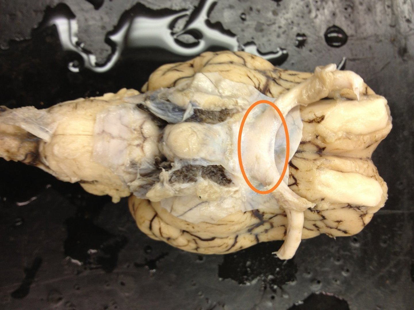 <p>point at which optic nerve fibers cross in the brain</p>