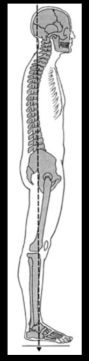 <p>flattening of the lumbar spine</p>
