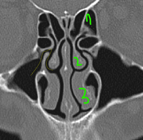 term image