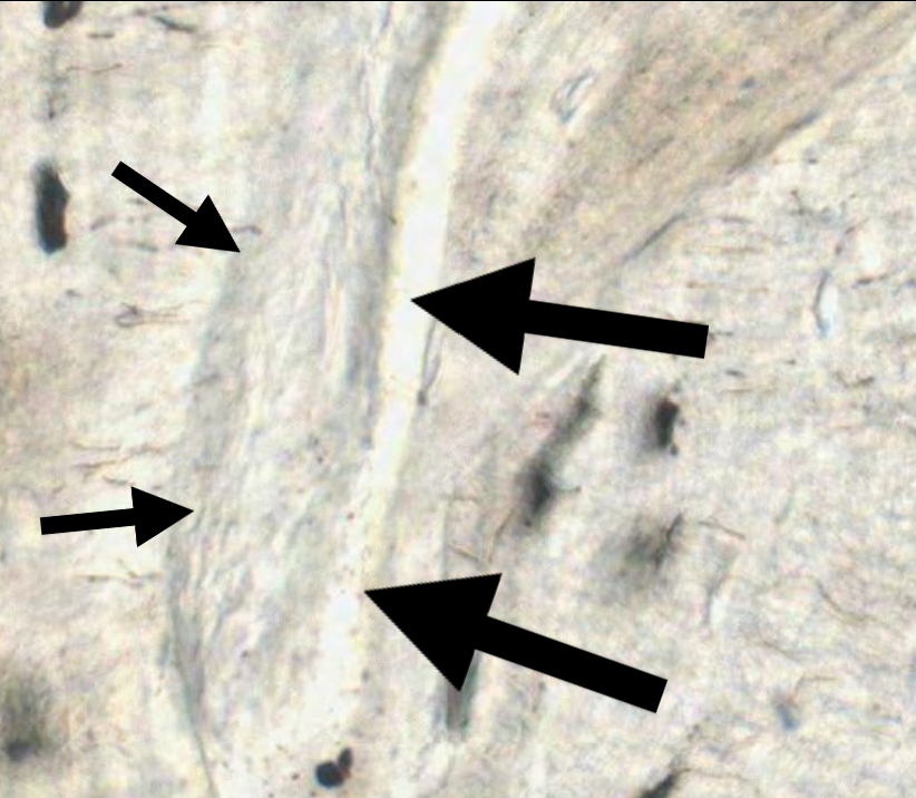 <p>What structure is pictured in the slide by the black arrows? (Ground Bone)</p>