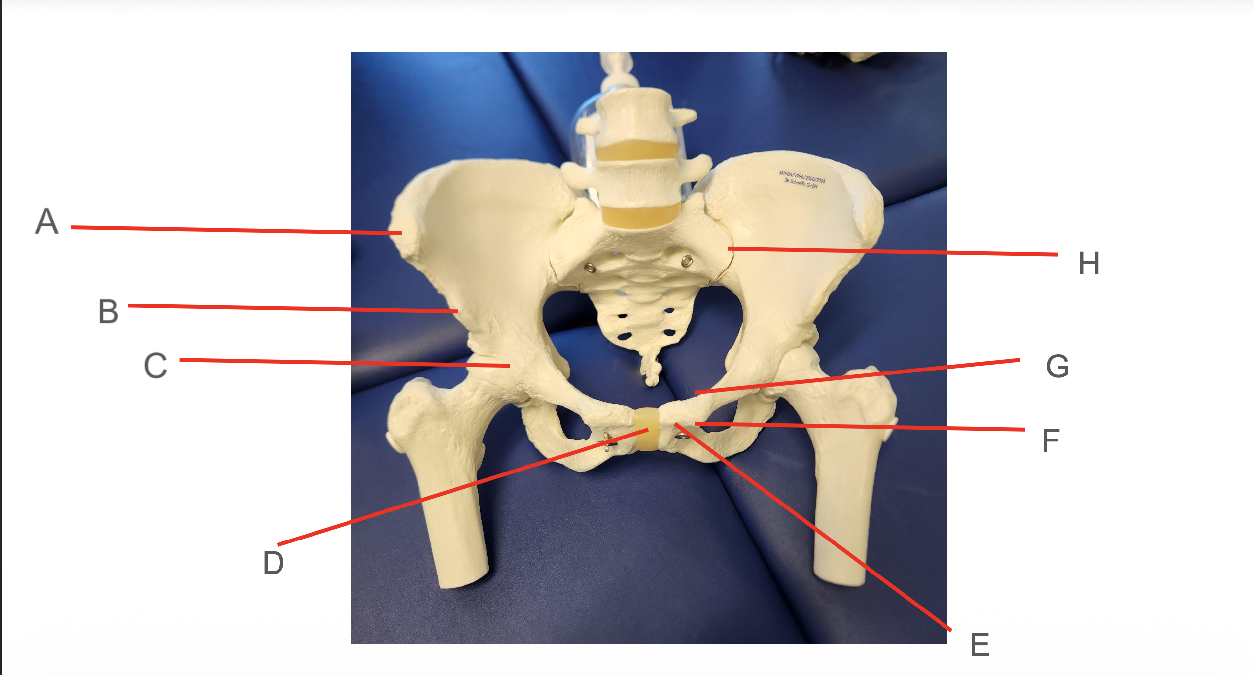 <p>Identify Structure G</p>