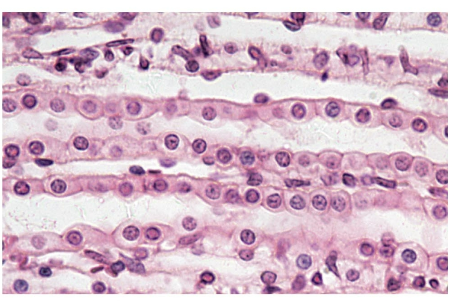 <p>what tissue is this</p>