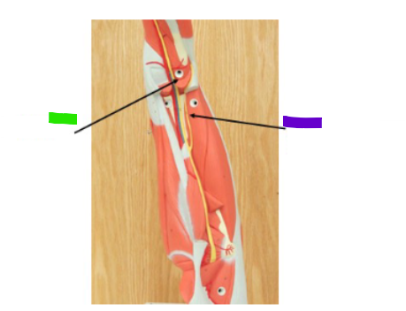 <p>What is the green arrow?</p>