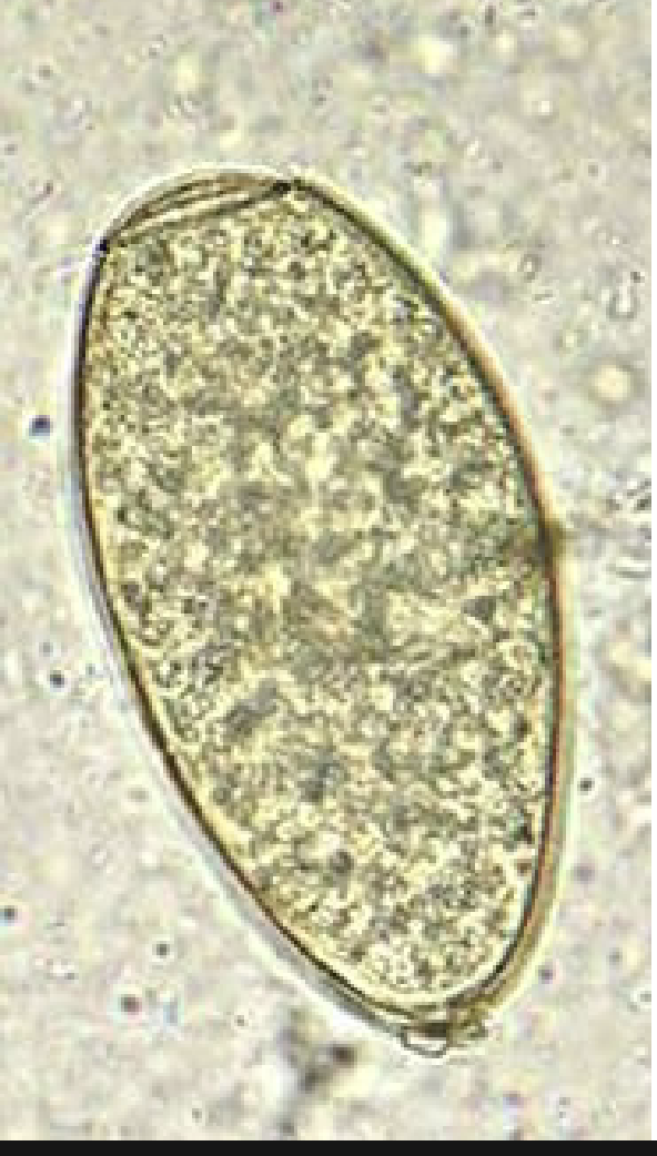 <p>-Eggs are identical between the 2 general</p><ul><li><p>Looks similar to D. latum but much larger</p></li></ul><p>-120 microns</p><p>-No shoulders</p><p>-Abopercular knob present</p><p></p>
