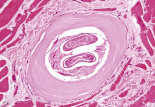 <p>What parasite is this?</p>