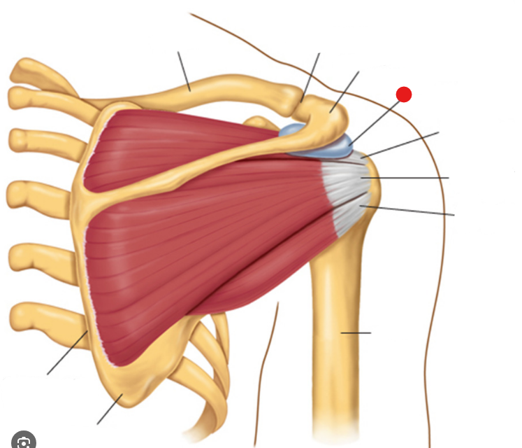 <p>Identify the structure pinned</p>