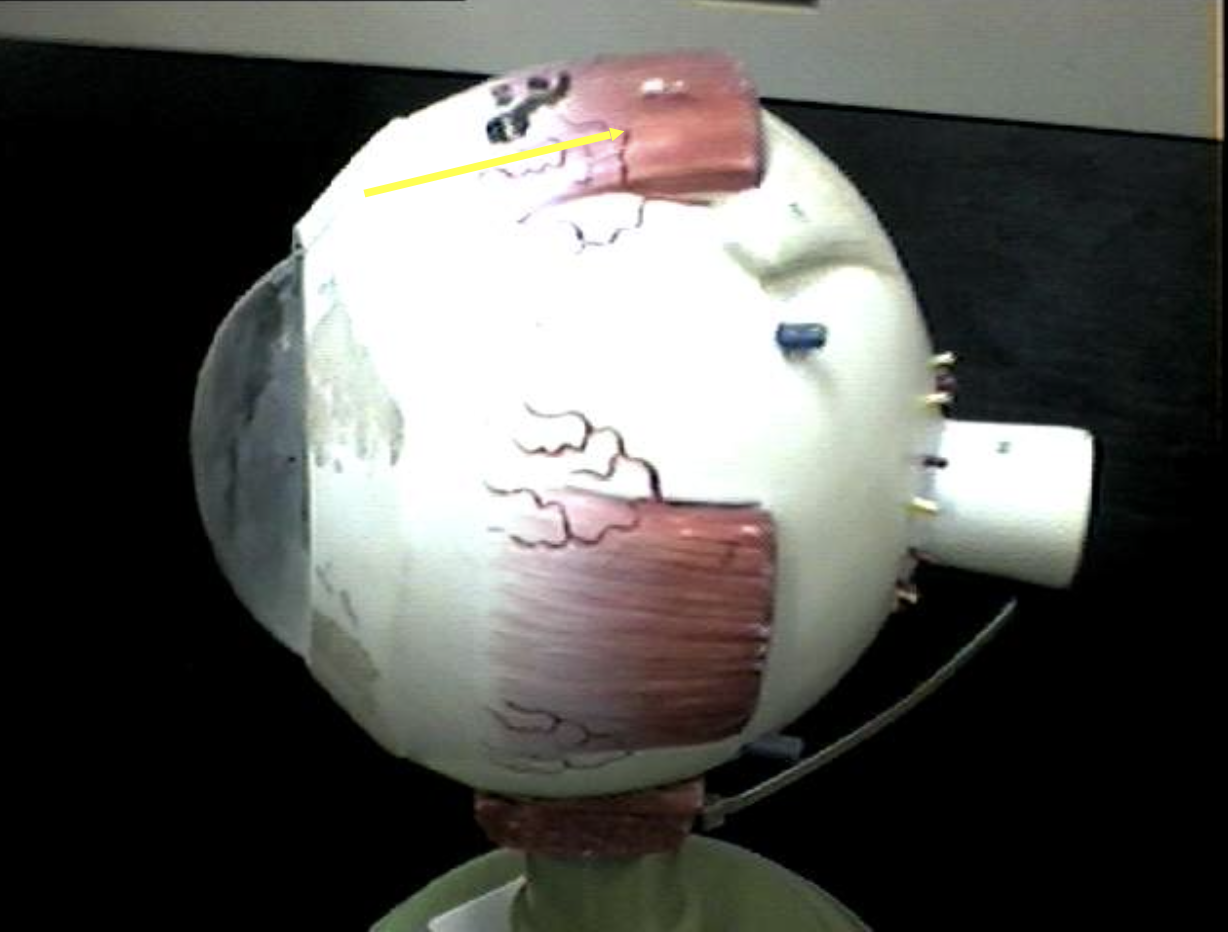 <p>Identify the eye parts. </p>