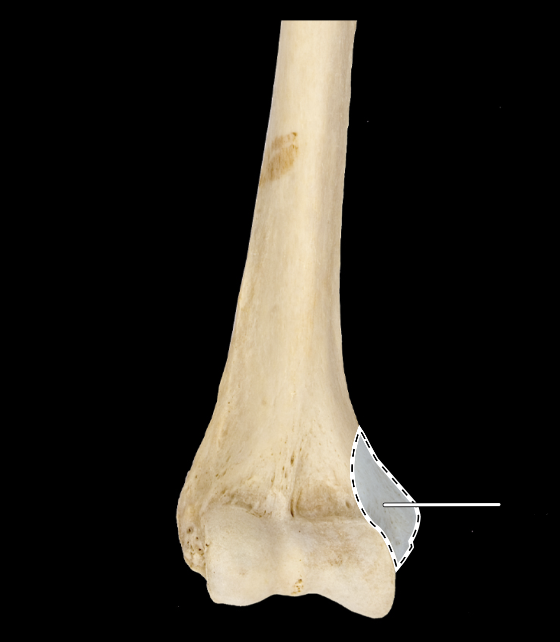 <p>anterior view</p>