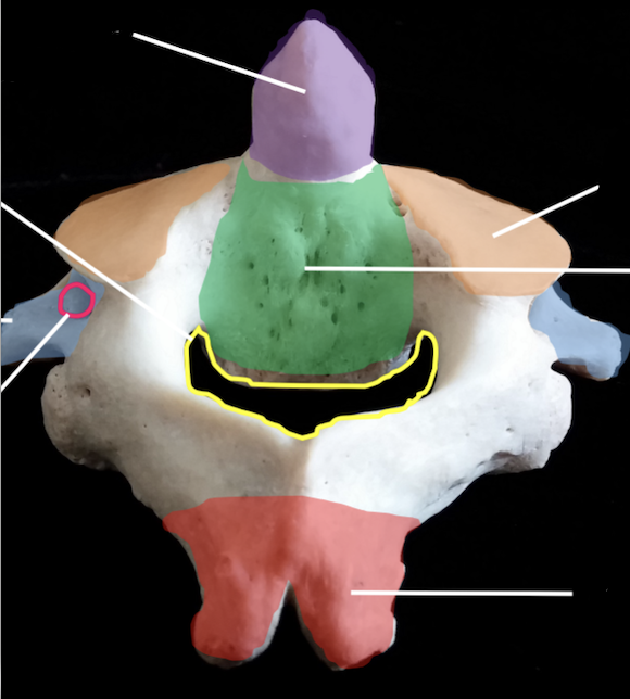<p>what bone is the highlighted purple area ? </p>