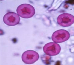 <p>Type of pollen? </p>