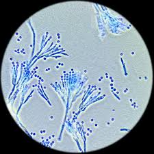 <p>This mode of asexual reproduction is flask-shaped containing spores</p><ul><li><p>Penicillium</p></li></ul><p></p>