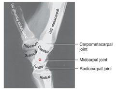 <p>Distal radius</p><p>Lunate</p><p>Capitate</p><p>3rd metacarpal</p>