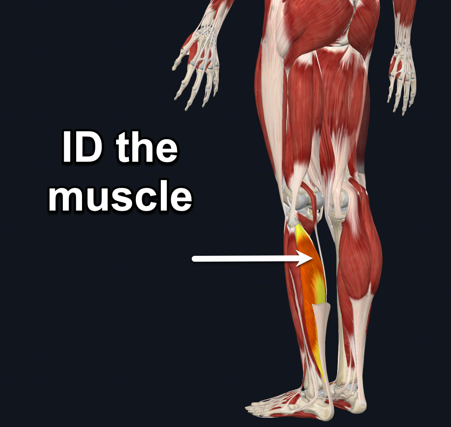 term image