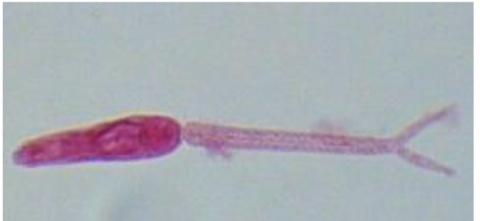 <p>what life cycle stage in the blood fluke <strong>infects</strong> humans?</p><p></p>