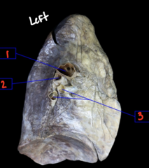 <p>What is labeled 3?</p>