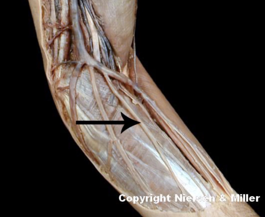 <p>The indicated vessel is the _ (anteromedial view of superficial veins of arm/forearm)</p>