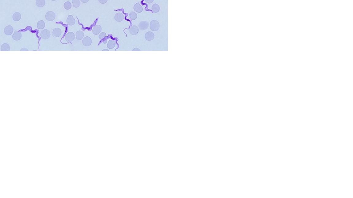 <p>Name the protozoan</p>