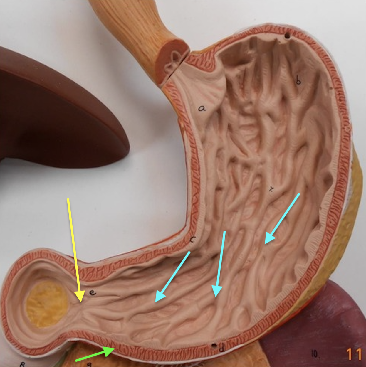<p><span data-name="yellow_circle" data-type="emoji">🟡</span> Identify structure</p><p><span data-name="green_circle" data-type="emoji">🟢</span> Identify region</p><p><span data-name="blue_circle" data-type="emoji">🔵</span> Identify structure</p>