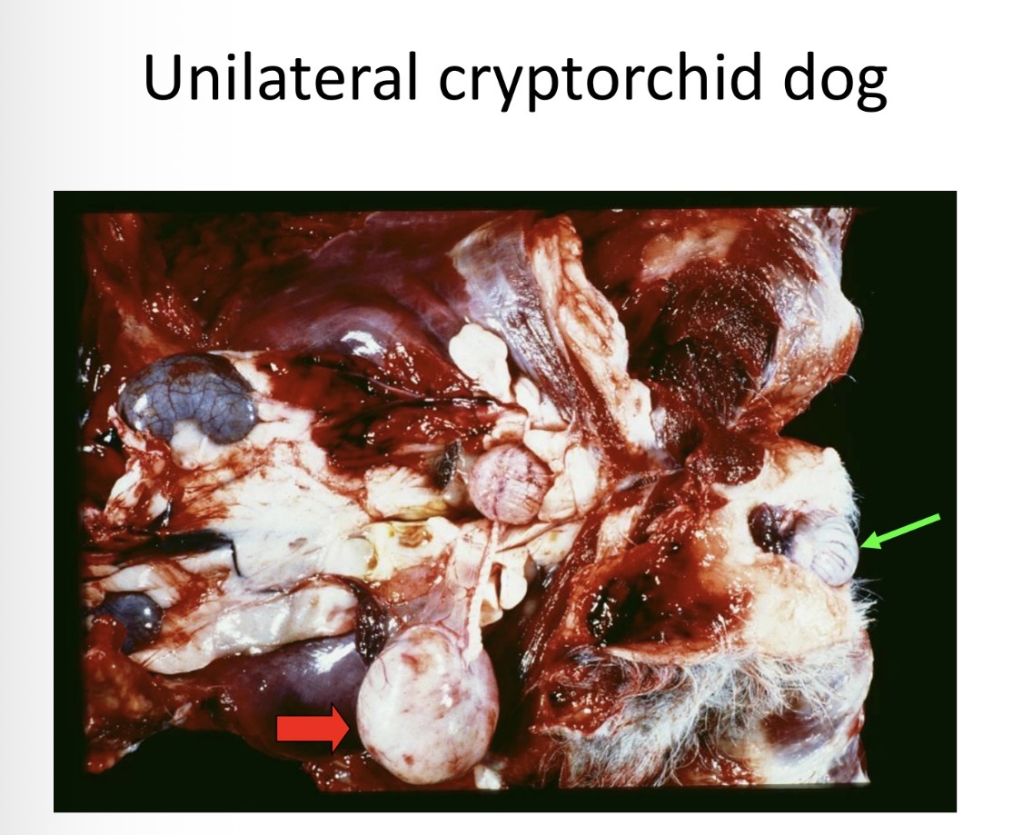 <p>cryptorchidism - effect if abd (not inguinal)</p>