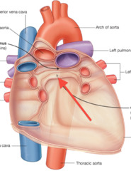 <p>Identify the structure</p>