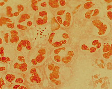 <p>PATHOGENIC BACTERIA:</p>