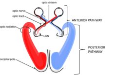 <p>origin of the optic nerve to the lateral geniculate nucleus</p>