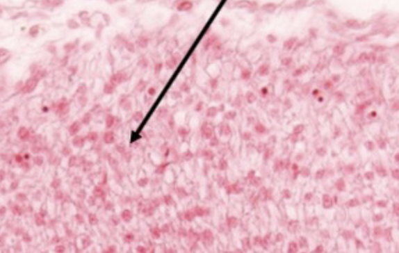 <p>classify the tissue indicated by the pointer</p>