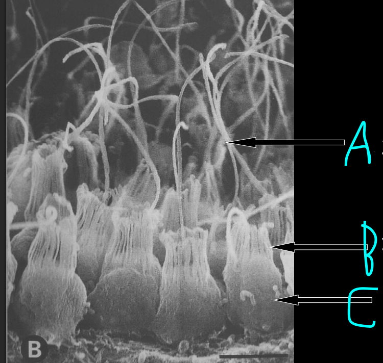 <p>Internal sponge labeling </p>