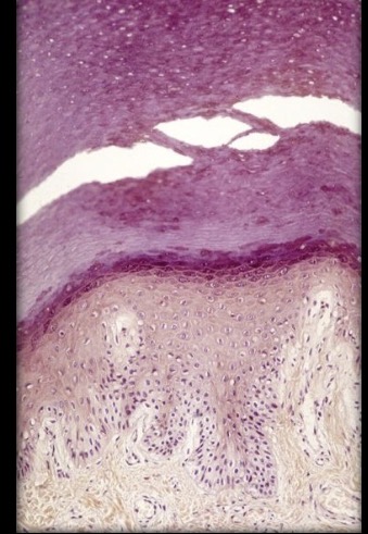 <p>What is the type tissue in this image?</p>