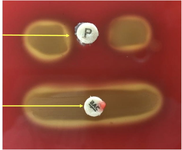 <p>what hemolysis is this?</p>